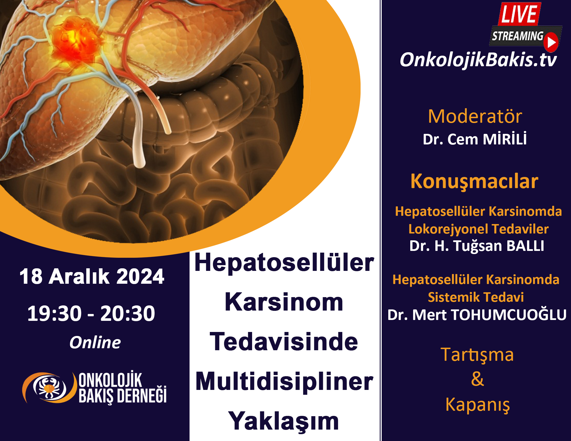 Hepatosellüler Karsinom Tedavisinde Multidisipliner Yaklaşım