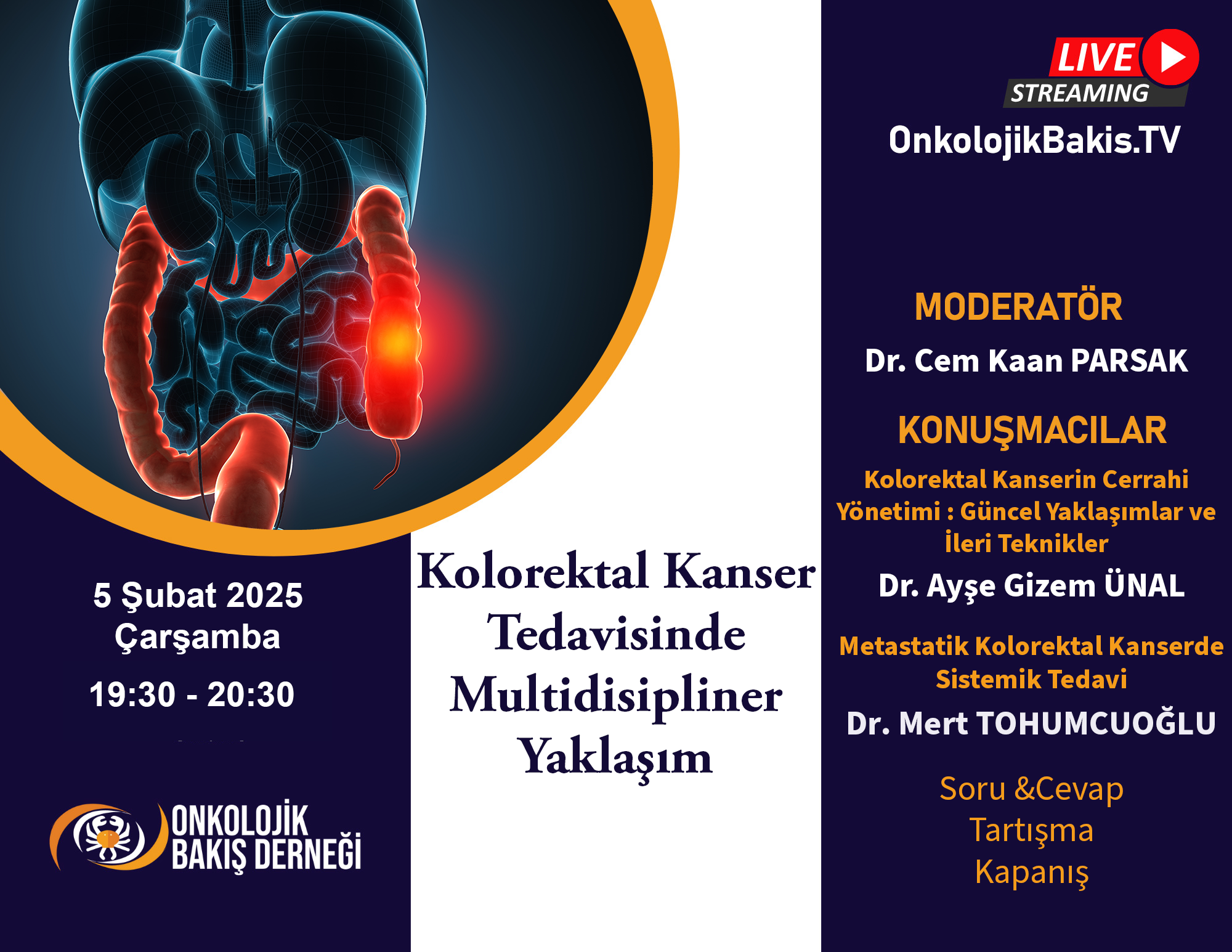 Kolorektal Kanser Tedavisinde Multidisipliner Yaklaşım